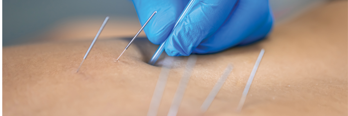 FUNCTIONAL DRY NEEDLING | Kit Carson County Memorial Hospital